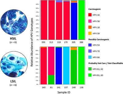 Abundance of HPV L1 Intra-Genotype Variants With Capsid Epitopic Modifications Found Within Low- and High-Grade Pap Smears With Potential Implications for Vaccinology